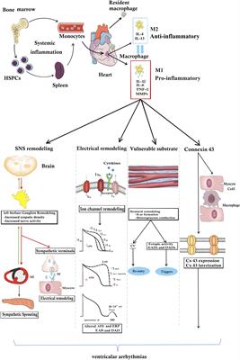 The Role of Cardiac Macrophage and Cytokines on Ventricular Arrhythmias